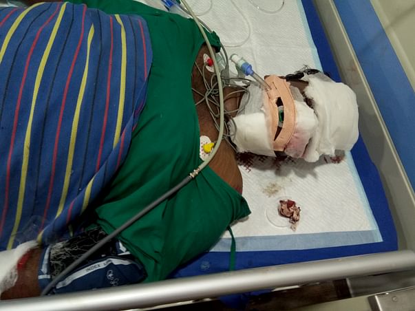 Help Kumar Babu, who went to donate blood,but met with accident