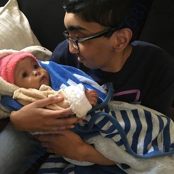 Philip with a baby who received free cleft lip surgery