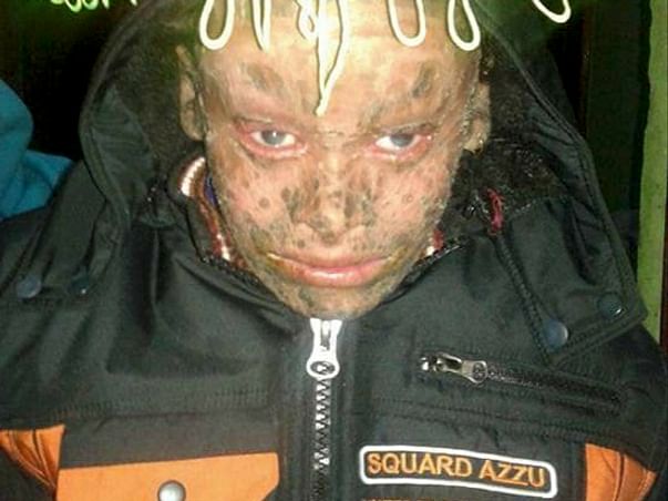 Help Prince Fight Rare Skin Disease