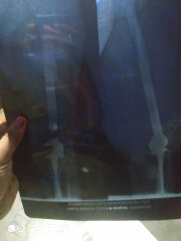 X ray report