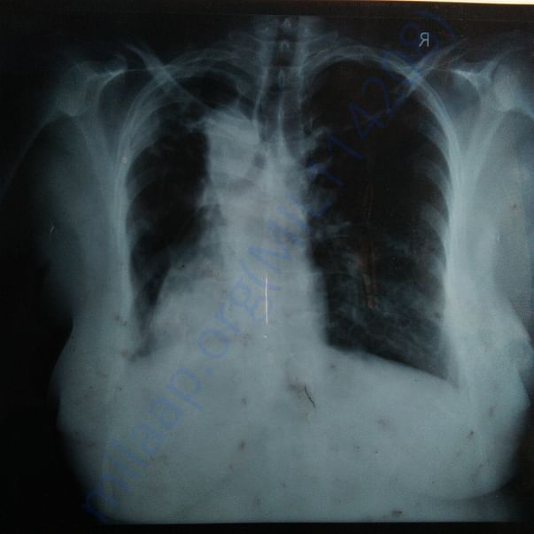 Medical Report