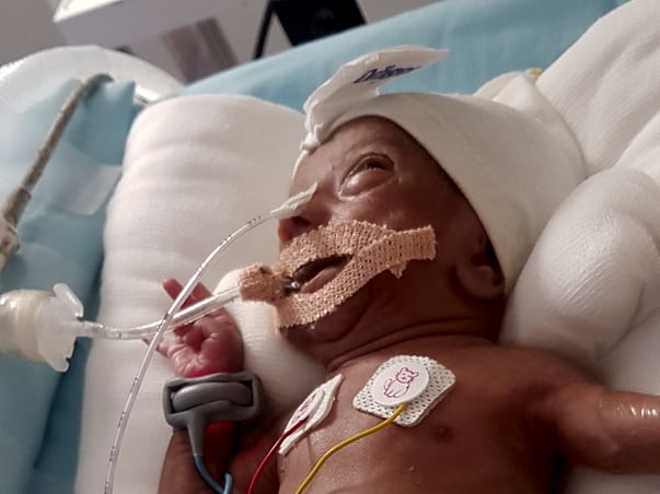 Help Baby Of Shalini: Premature Birth