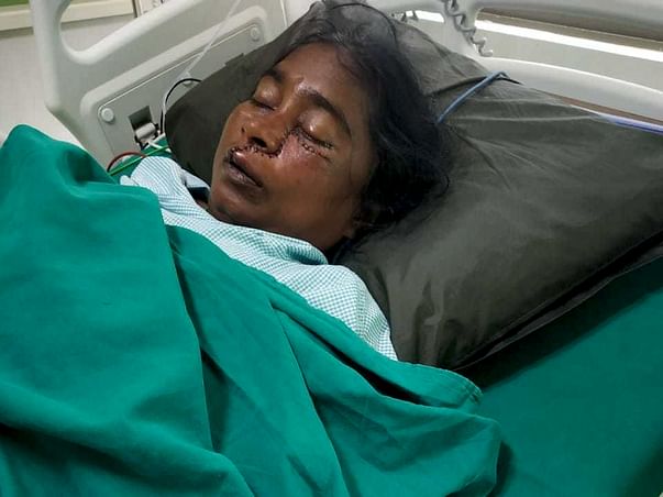 Please Help My Mother (Nilaveni), Fight Fungal Infection