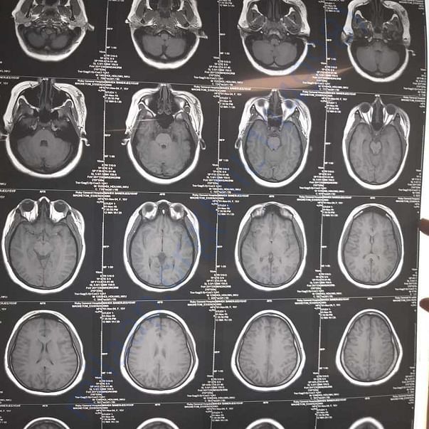 Medical Report