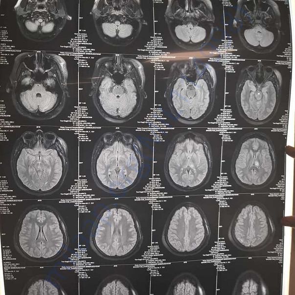 Medical Report