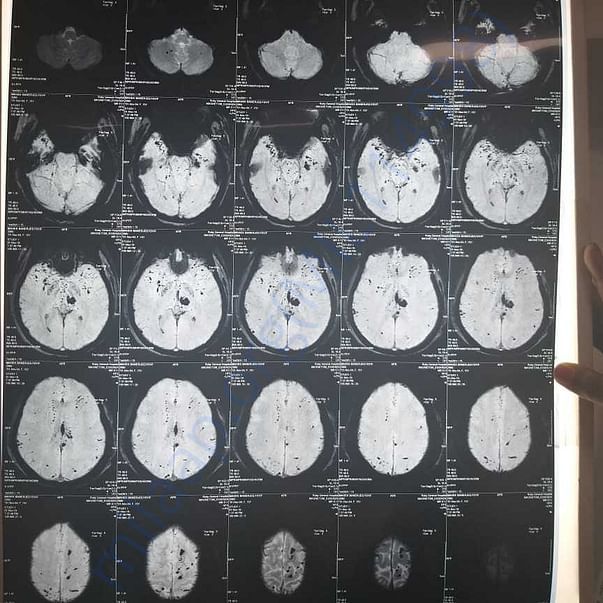 Medical Report
