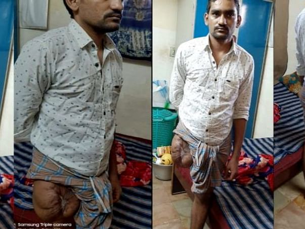 Please help Amzath to undergo a knee prosthetic surgery
