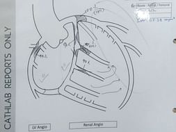 Father Fighting with 80% Heart Damage & Leak Valve need Urgent Surgery