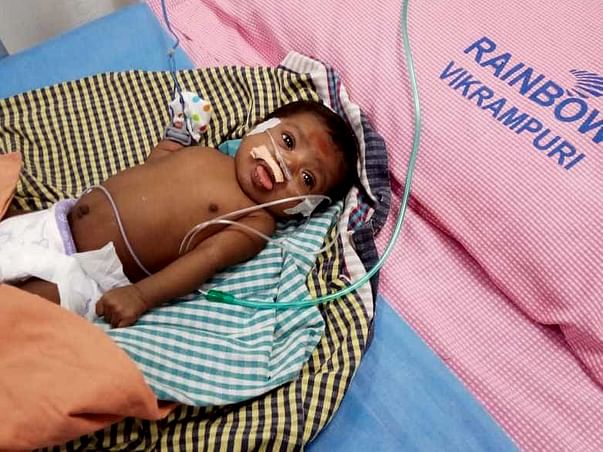 Save The 1-month-old Small Baby Recover From Lungs Complication