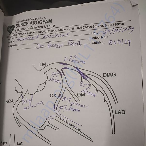 Angiography details