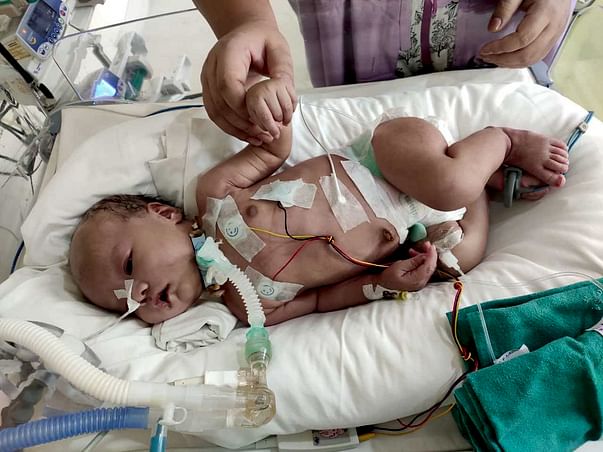 Help Save Baby Zakyui