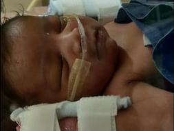 21 Days Old Baby of Shibani Needs Your Help Fight Blood,lungs Infection and Blood Clot in Brain