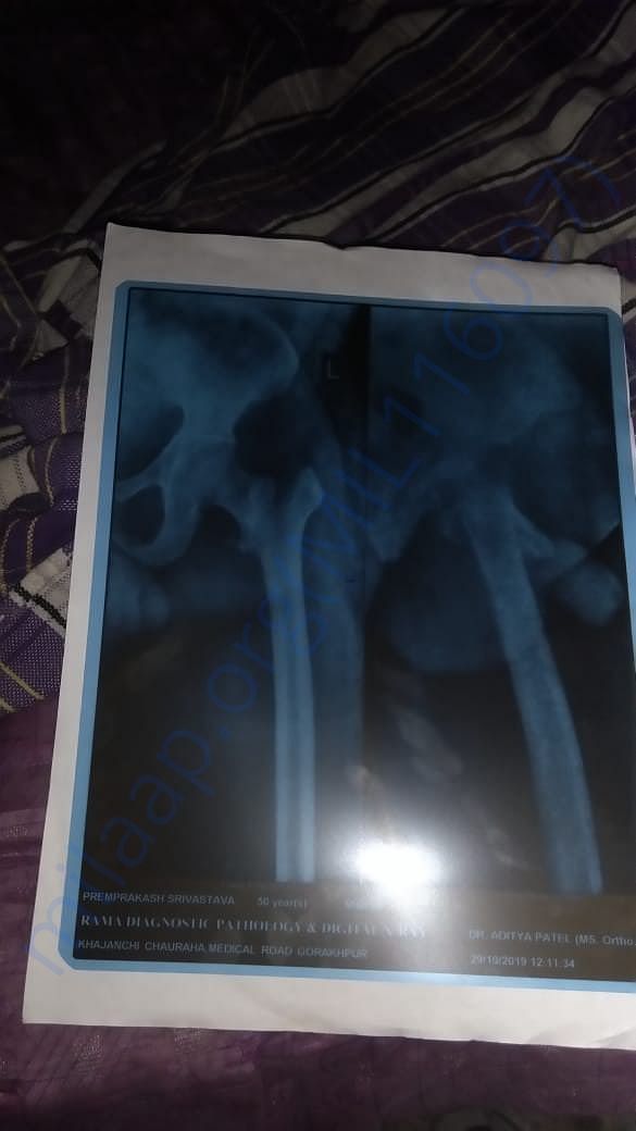 x ray