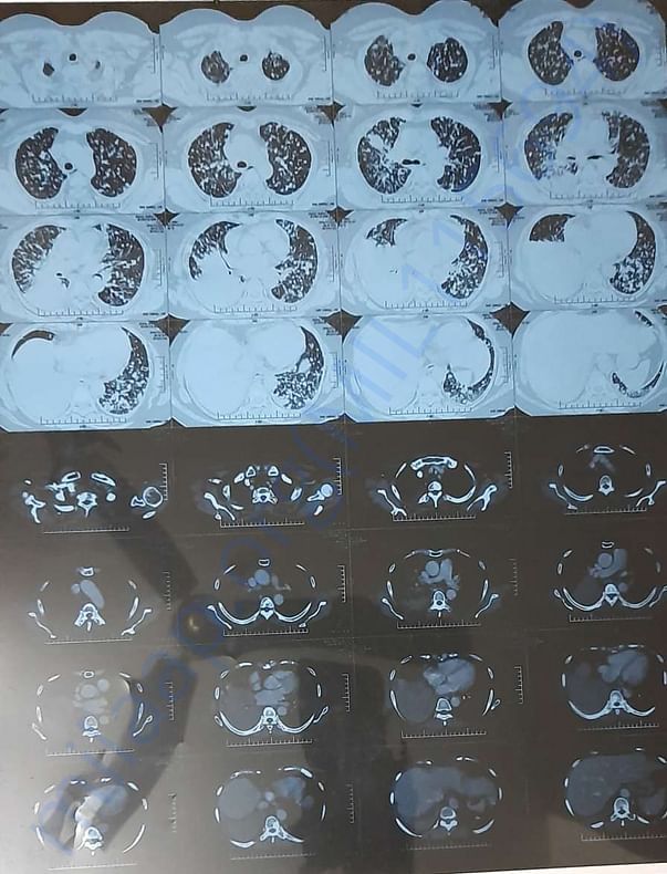 xray image1