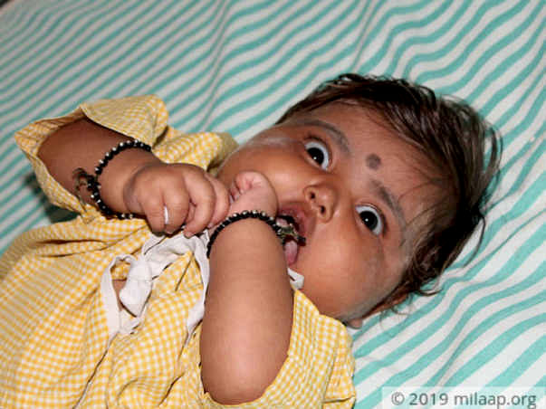 A 6 Month Old Is Struggling With Bone Marrow Transplantation, Help Her