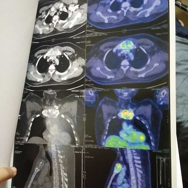 Medical Report