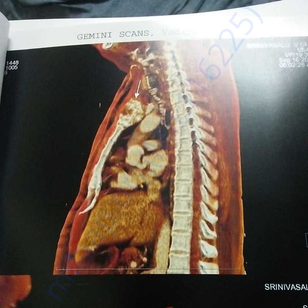 Medical Report