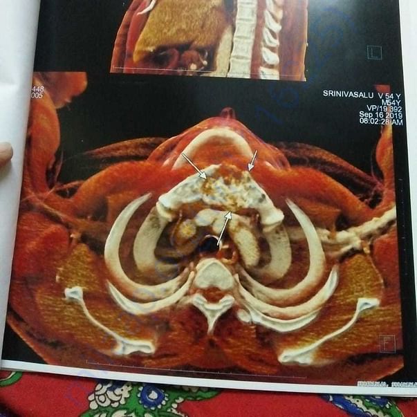 Medical Report