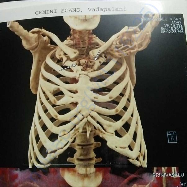 Medical Report