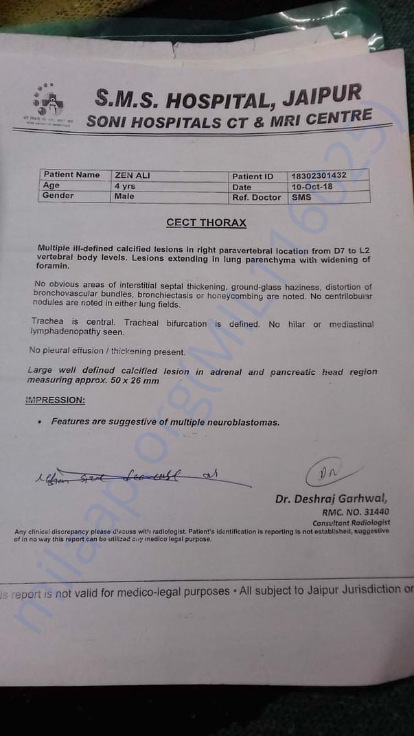 Zain ali Report