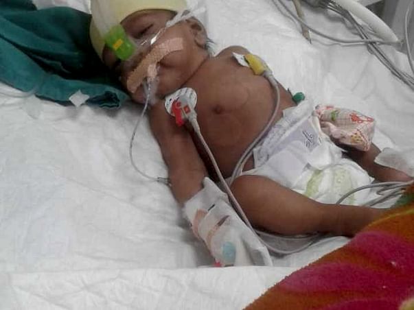 Support Baby Of Mamta recover From Severe Pneumonia