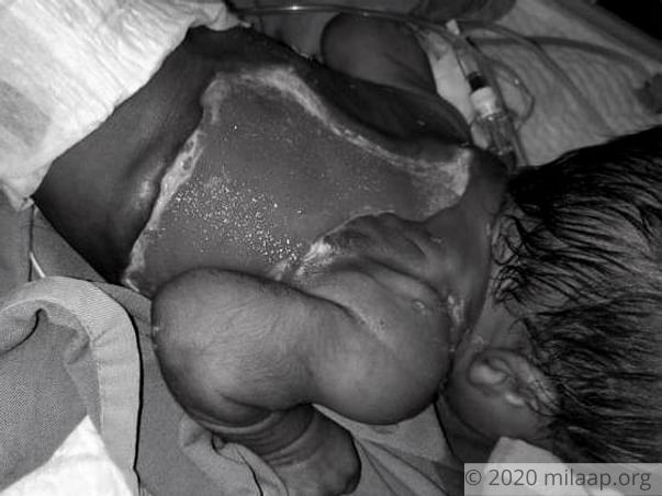 My new born son is in the ICU battling for his life