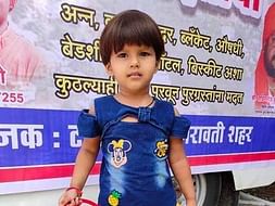 Help 4-Year-Old, Kshitija Ninnore Fight Burn Injuries