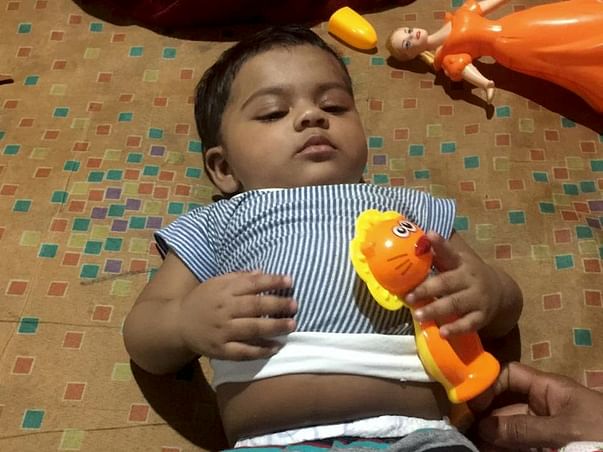 7 Months Old Baby Aira Needs Your Help To Recover From Liver disease