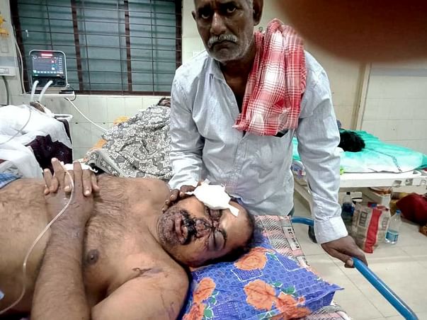 Help Sateesh Podila Undergo Plastic Surgery