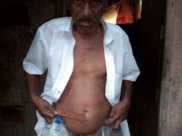 Help My Father Recover From Road Traffic Accident