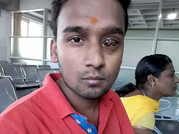 Help Arun Get His Eyesight Back