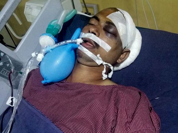 Support Vijay Kumar recover from Road traffic accident with polytrauma