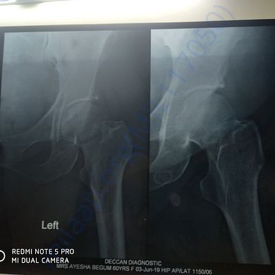 Medical Report