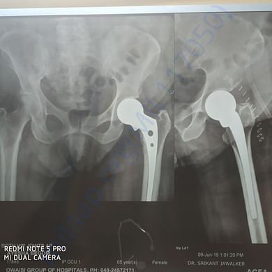 Medical Report