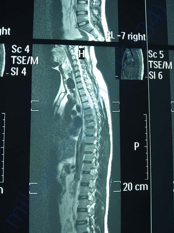 mri report 1