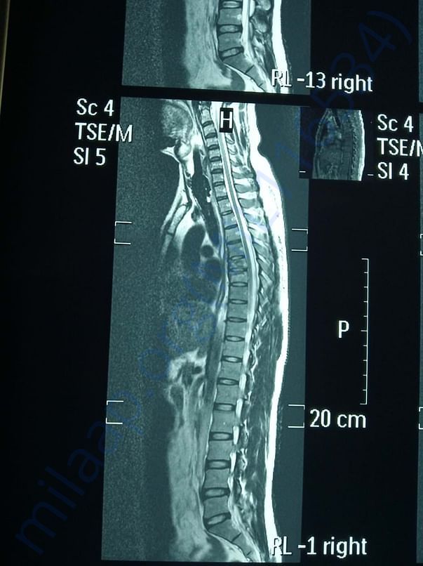 mri report 2