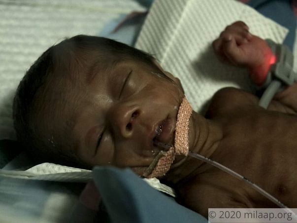 Help Our Twin Babies Recover