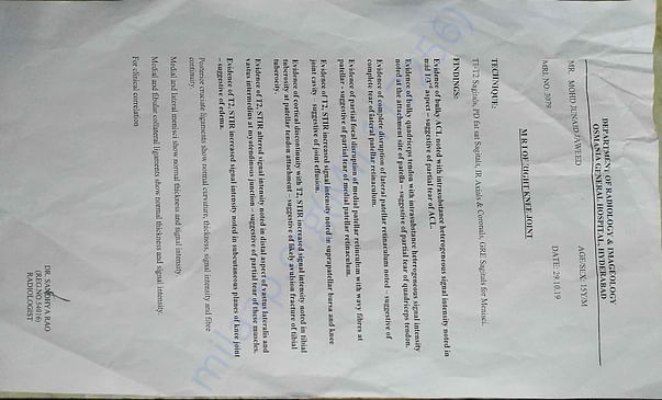 MRI report