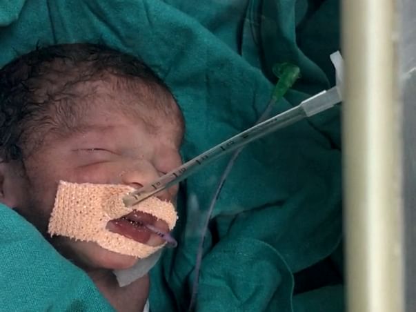 Help baby of Sujata recover from Intensive Care Unit