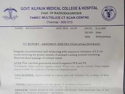 60 Years old Kothandan Needs Your Help To Fight Stomach Cancer