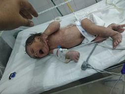 Help to baby of jyoti urgently treatment