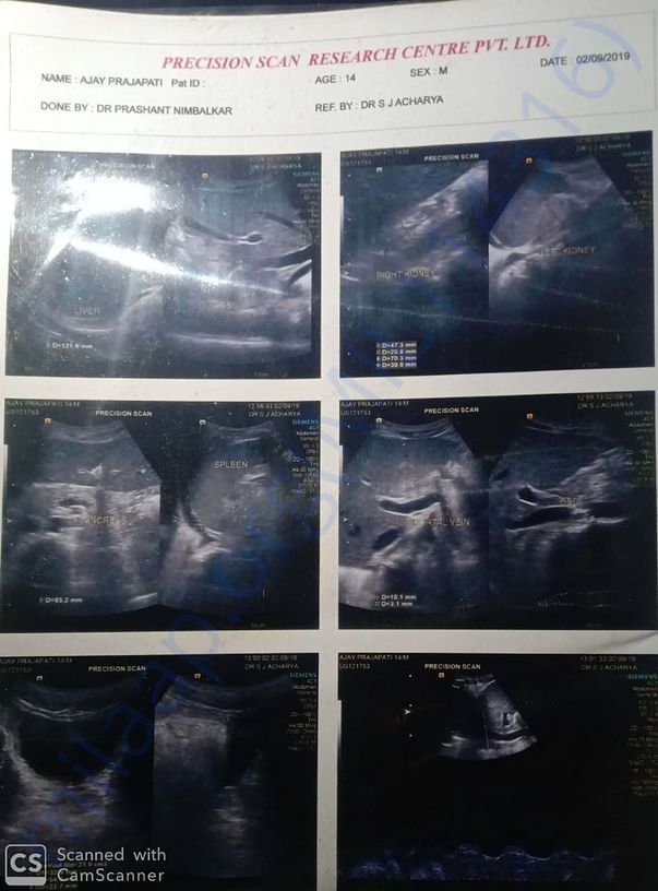 ajay kidny sonographi