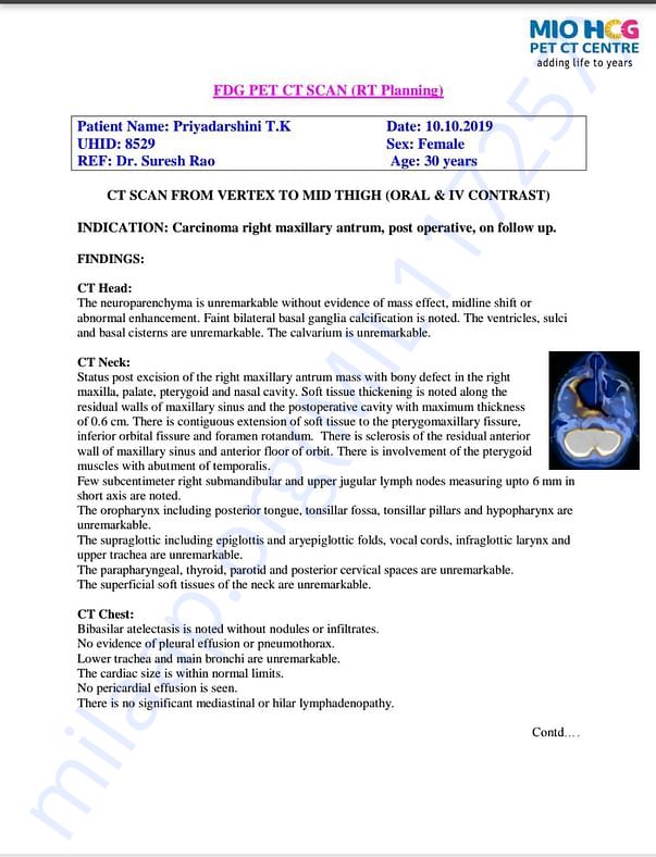 Pet Scan Report(3)