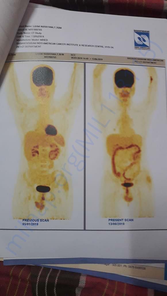 Scan