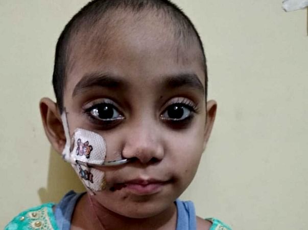 7 years old Neha Needs Your Help To Fight Corrosive Esophagus Injury