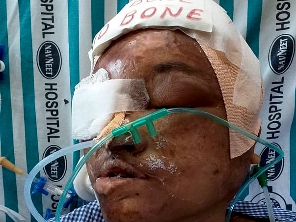 This 45 Years Old Needs Your Urgent Support In Fighting Brain Tumor