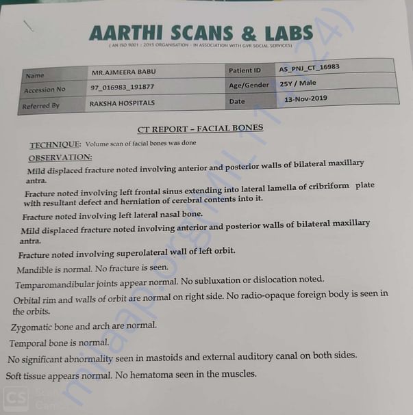 CT BRAIN