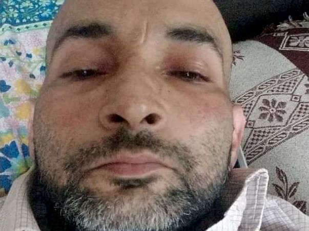 Shardendu Is Fighting Squamous Cell Carcinoma, Help Him.