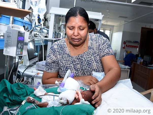Help Sumathi's Premature Baby Recover