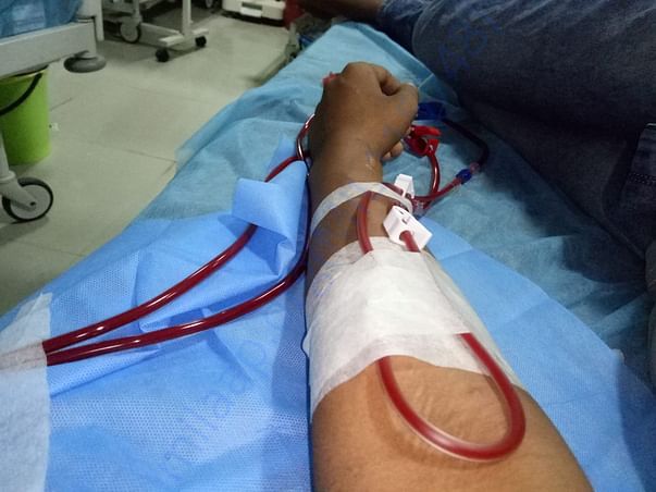 Dialysis